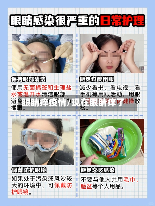 眼睛痒疫情/现在眼睛痒了
