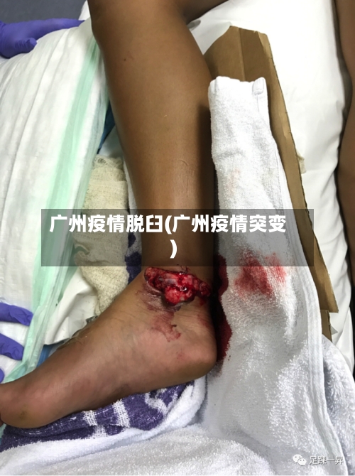 广州疫情脱臼(广州疫情突变)-第2张图片