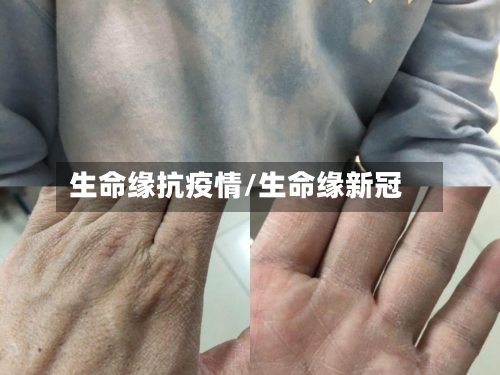 生命缘抗疫情/生命缘新冠-第2张图片