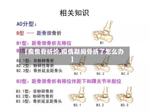 【疫情骨折价,疫情期间骨折了怎么办】-第3张图片